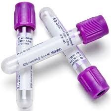 EDTA Tubes (Whole Blood)